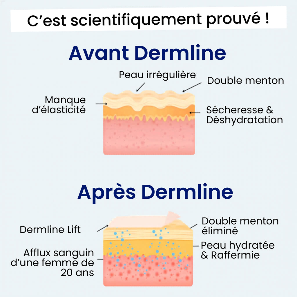 Le Dermline™ Lift