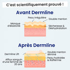Le Dermline™ Lift