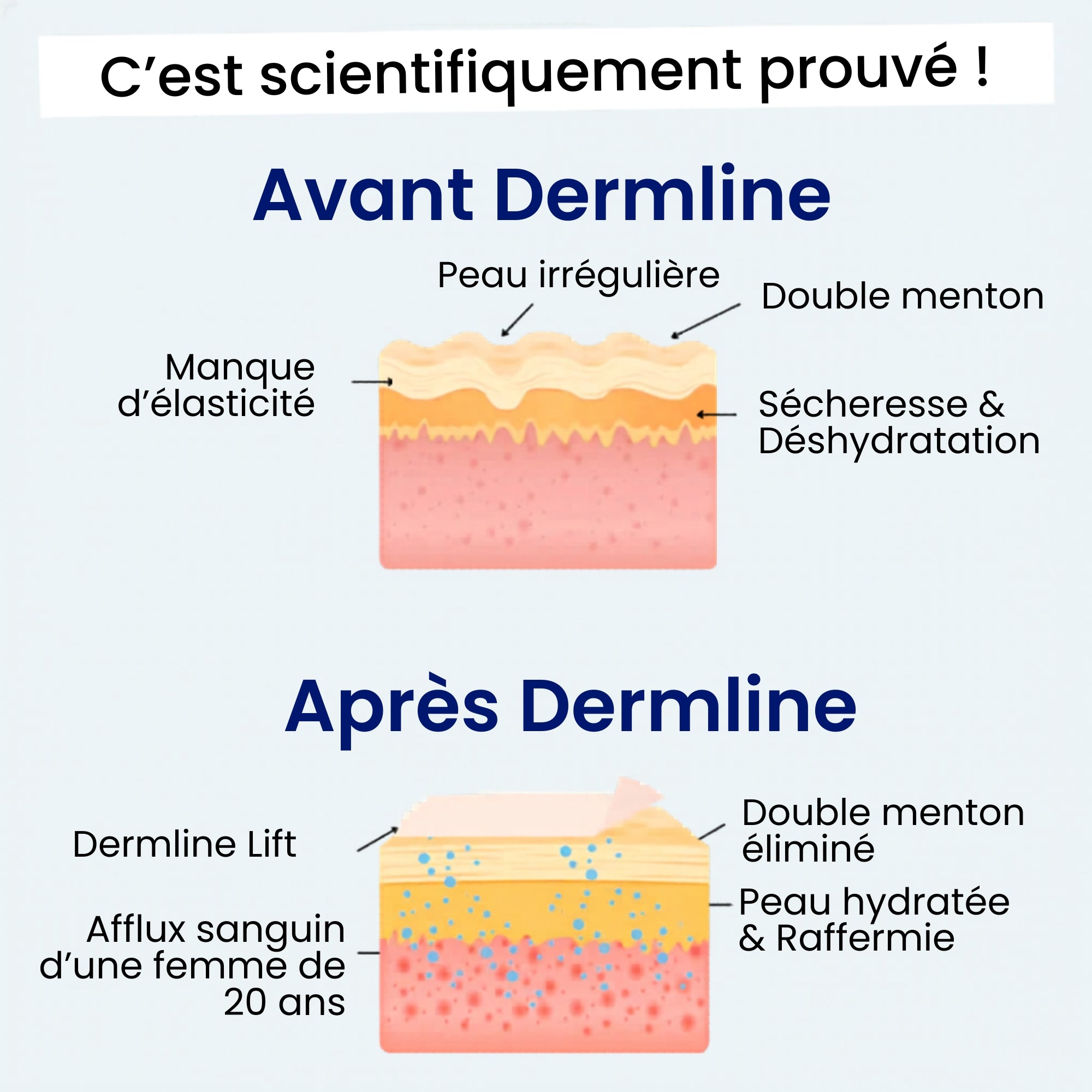 Le Dermline™ Lift
