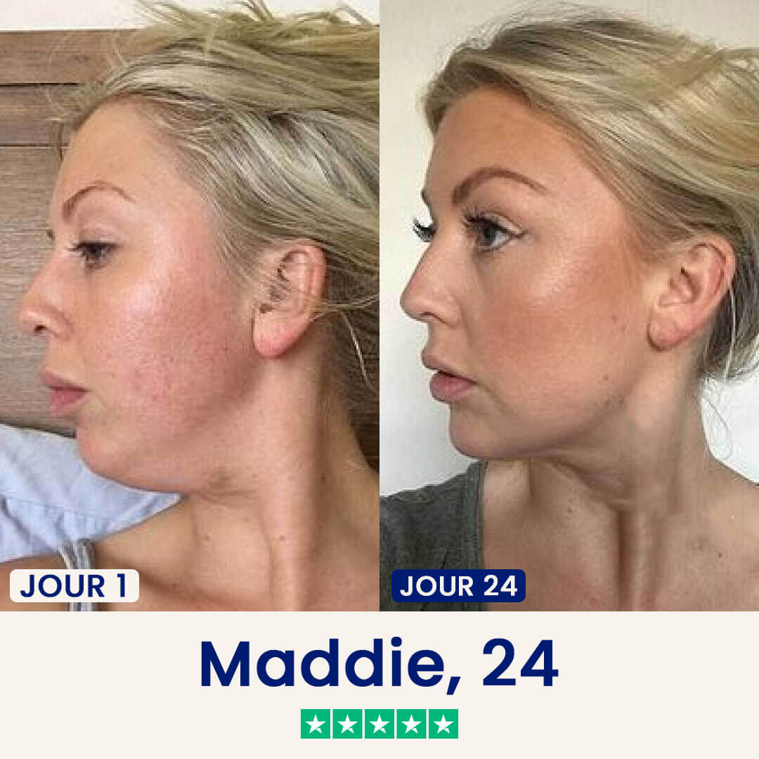 Le Dermline™ Lift