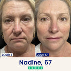 Le Dermline™ Lift
