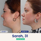 Le Dermline™ Lift