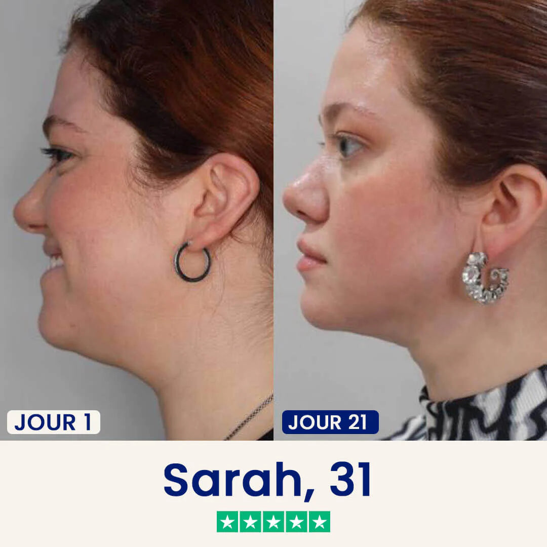 Le Dermline™ Lift